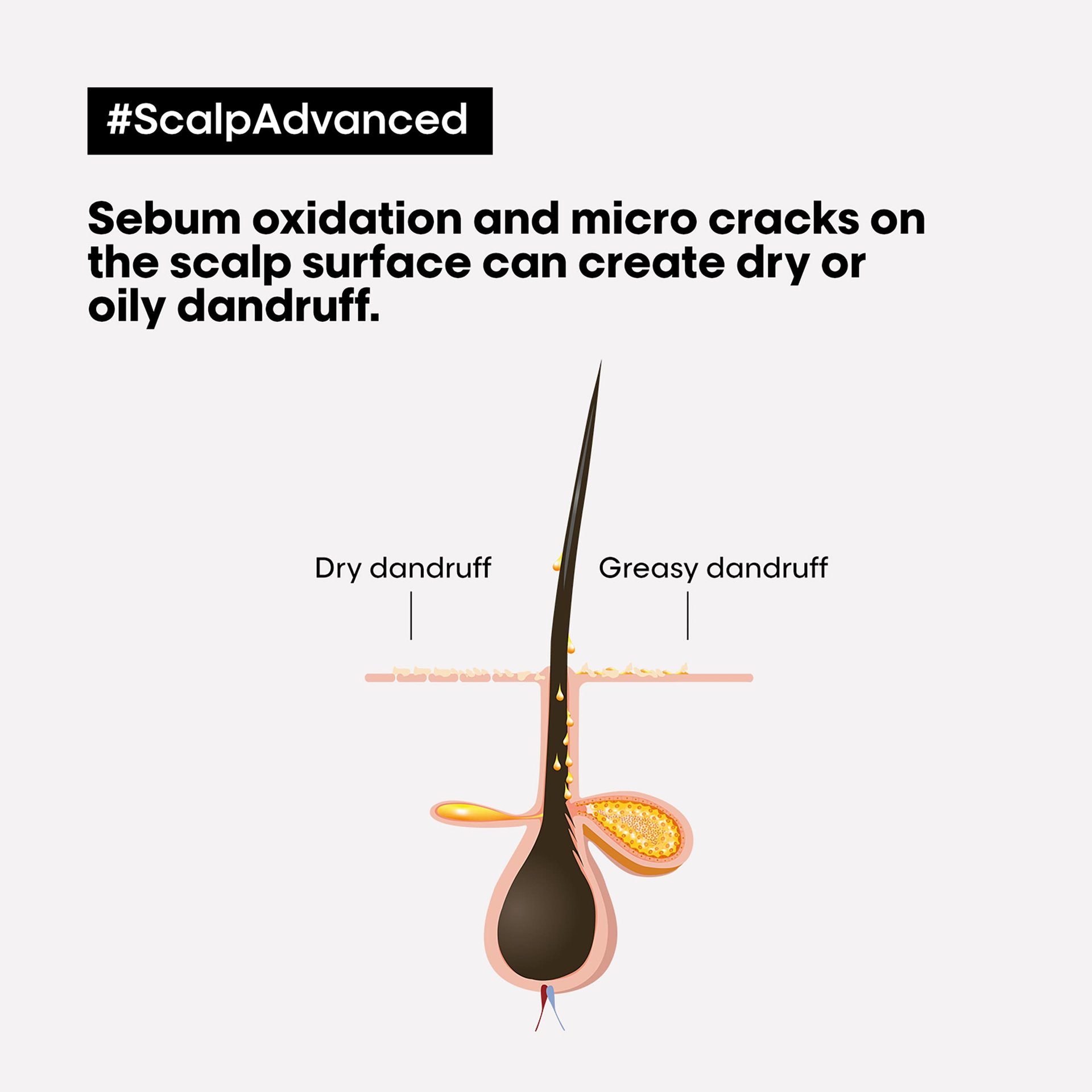 scalp-advanced-shampoo-dermorregulador-antimolestias7